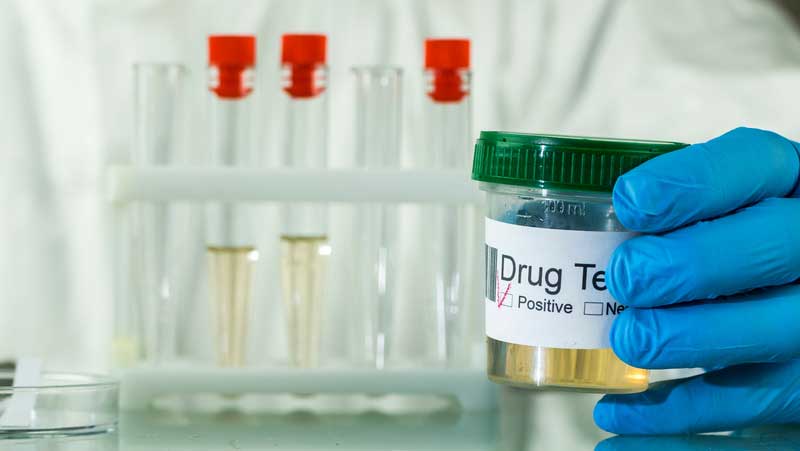 How to Prepare for a Drug Test: What to Know Before You Go